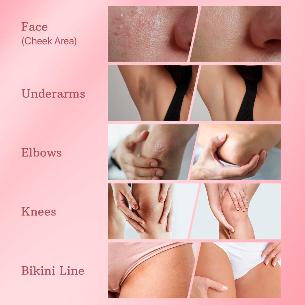 ESSENLIS dark spot remover underarms cream demonstrates brightened underarm skin and evenness.