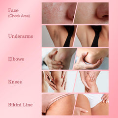ESSENLIS dark spot remover underarms cream demonstrates brightened underarm skin and evenness.