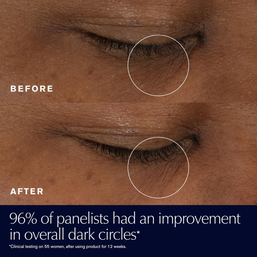 Estée Lauder Advanced Night Repair Eye application closeup demonstrating quick absorption