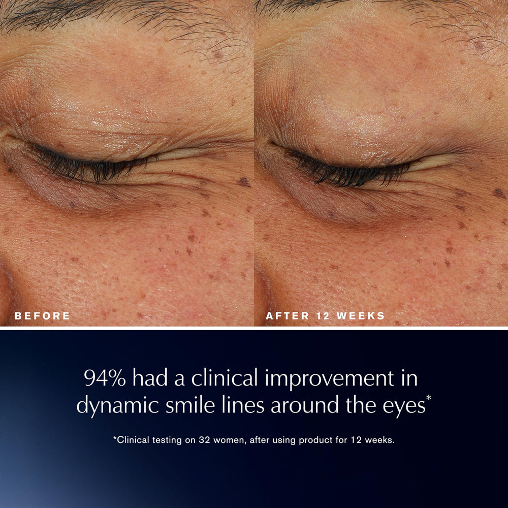 Estée Lauder Eye Lift close-up on lids and crow's feet.