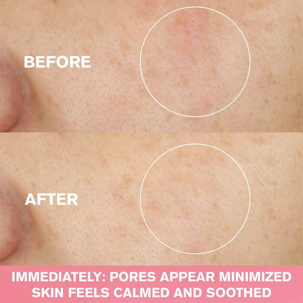 Mask-application scene demonstrates weekly purifying treatment for clearer-looking pores.