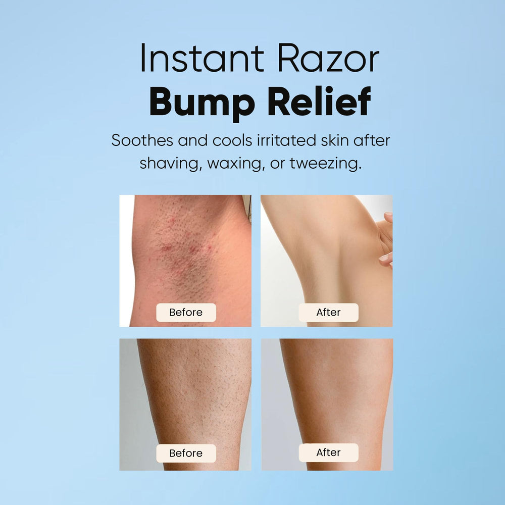ESTETIST Razor Bump Roll-On cooling effect for post-shave comfort