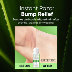 Estetist Razor Bump Stopper bikini-area roll-on eases irritation