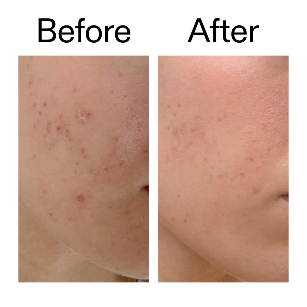 Etiqueta del The INKEY List Mandelic Acid Treatment, ingredientes y uso