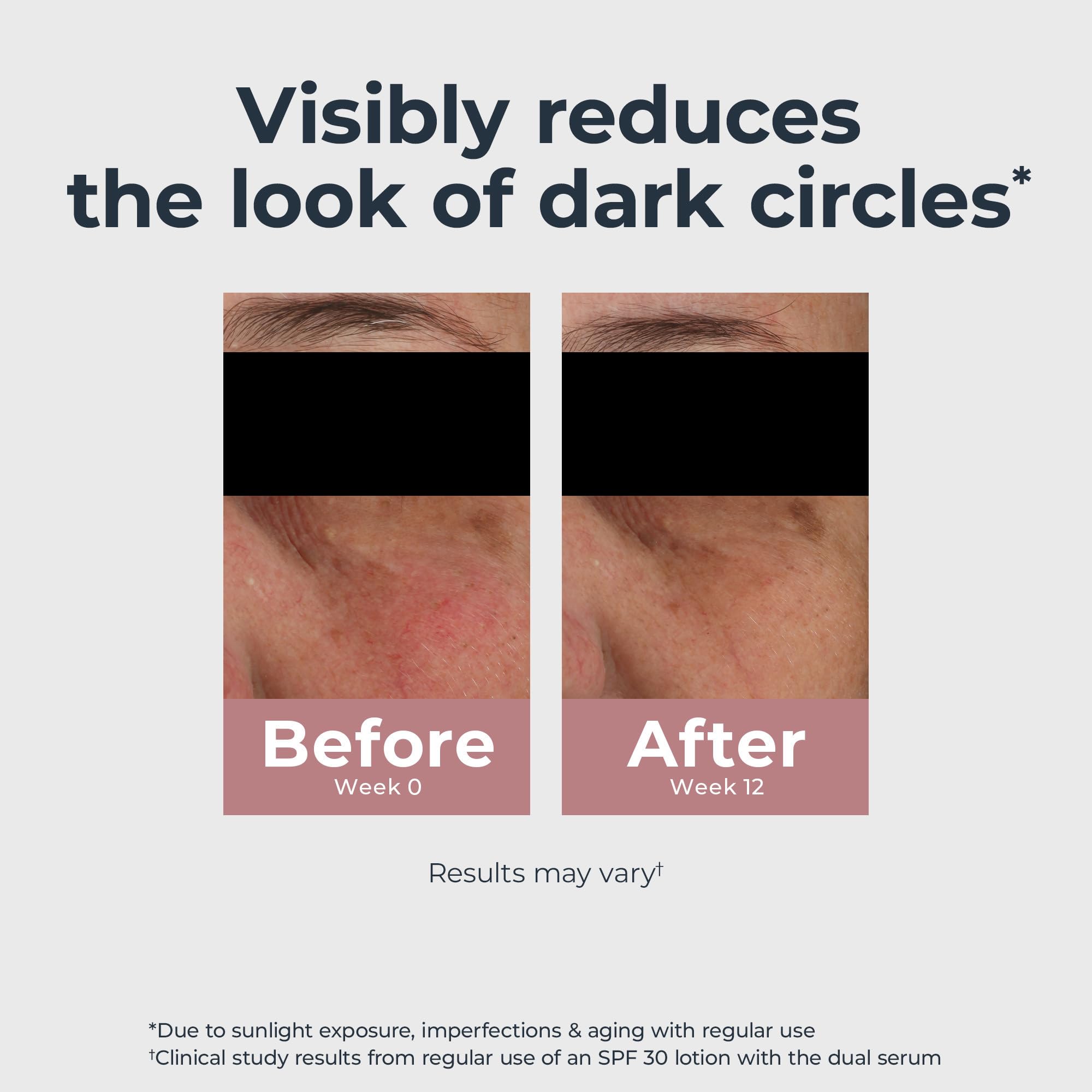 Eucerin Radiant Tone Eye Cream with light-reflecting pigments for instant brightness