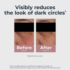 Eucerin Radiant Tone Eye Cream with light-reflecting pigments for instant brightness