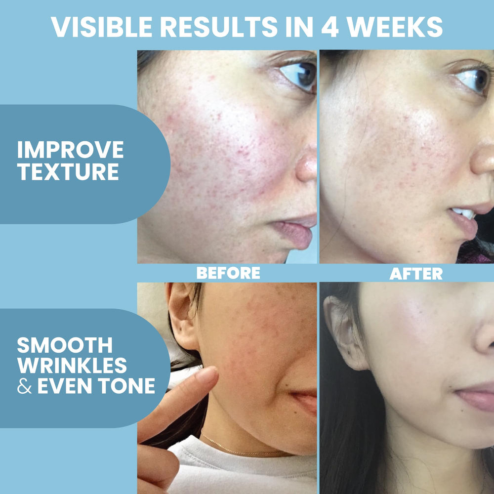 Aplicación diaria del sérum Eva Naturals en rostro y cuello