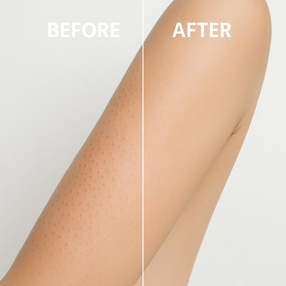 Everclearnow exfoliante glúteos: textura más suave en zonas difíciles.