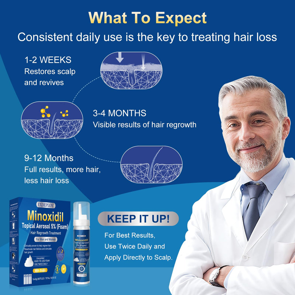 Exdeploy biotin-infused minoxidil foam bottle highlighting enriched formula.
