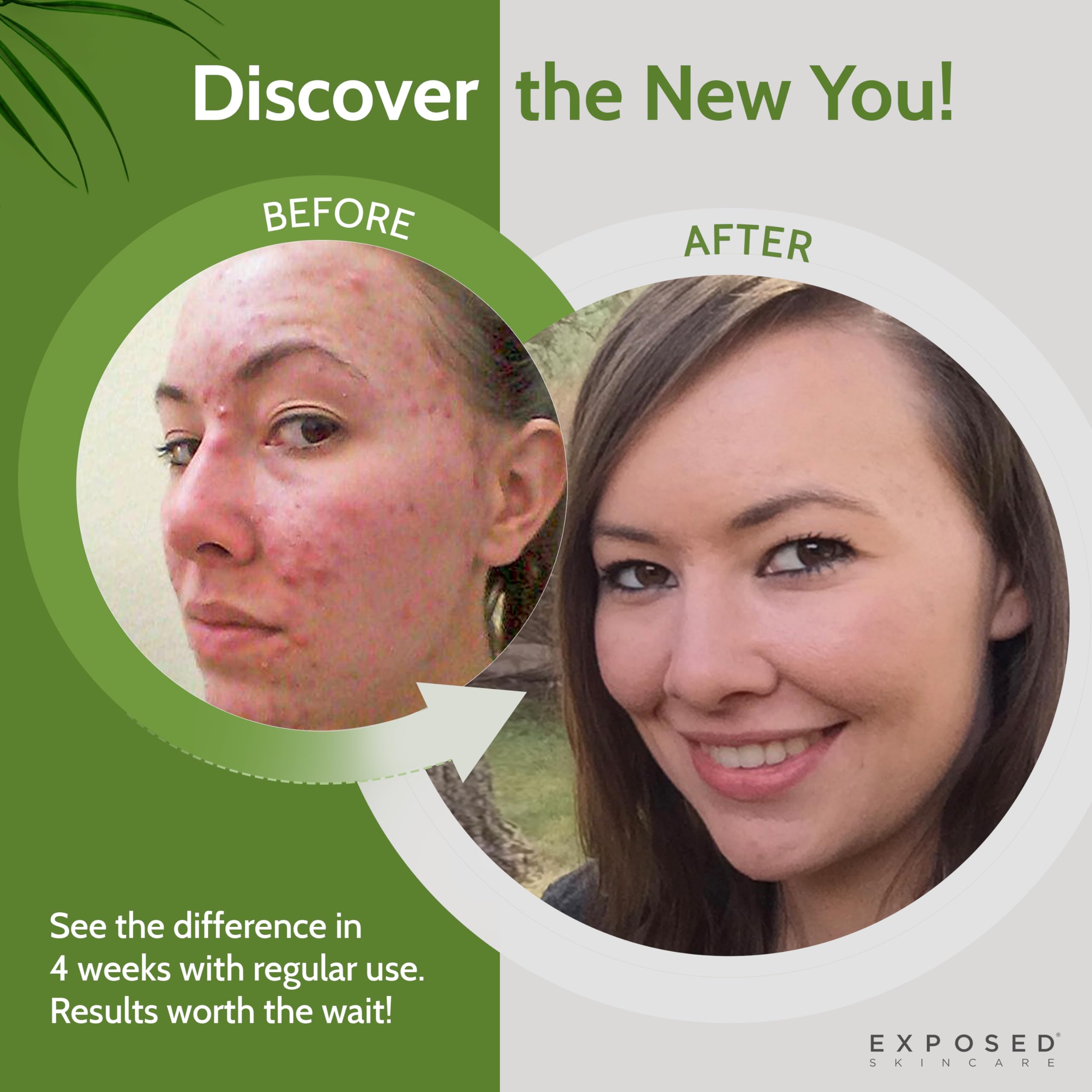Exposed Skin Care Tónico: textura sedosa al aplicar para sensación fresca.