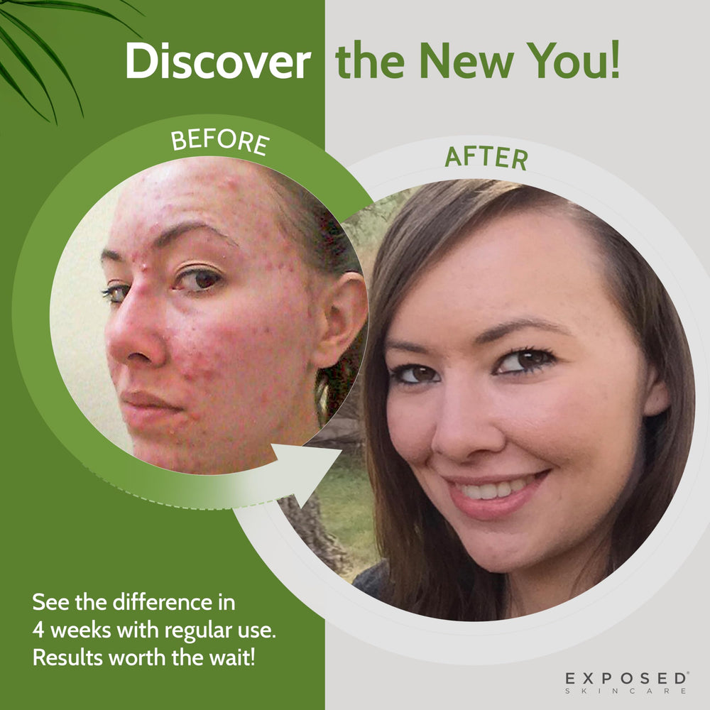 Exposed Skin Care Tónico: textura sedosa al aplicar para sensación fresca.