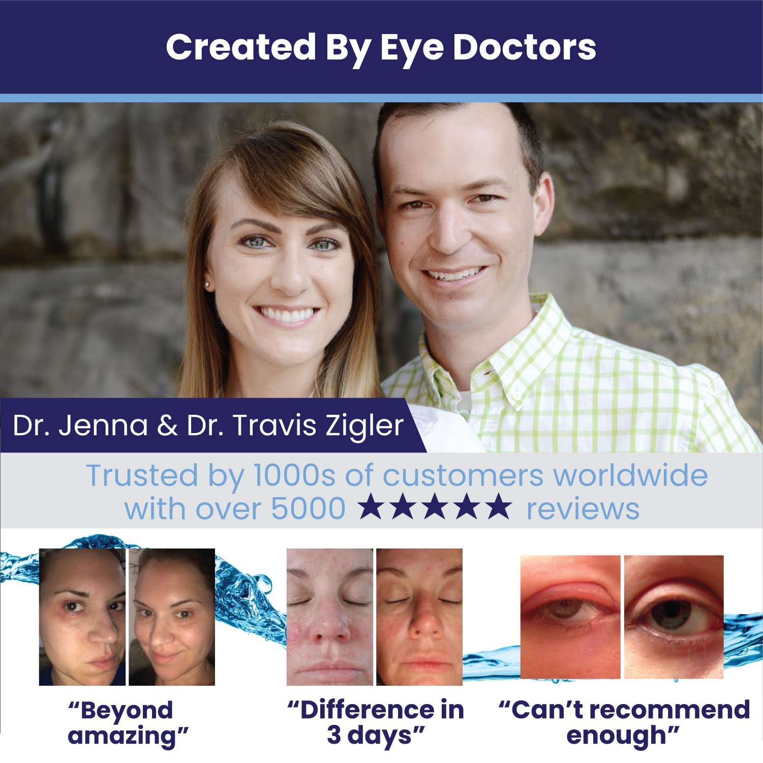 Eye Love brand story image highlighting donations to eye care causes.