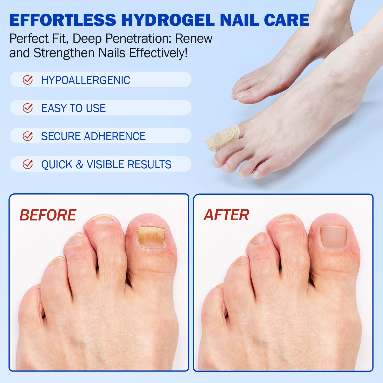 Hydrogel FANSHI patches conform to nail surface for comfort.