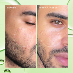 Farmacy papaya enzyme exfoliation visual indicates gentle surface cleansing