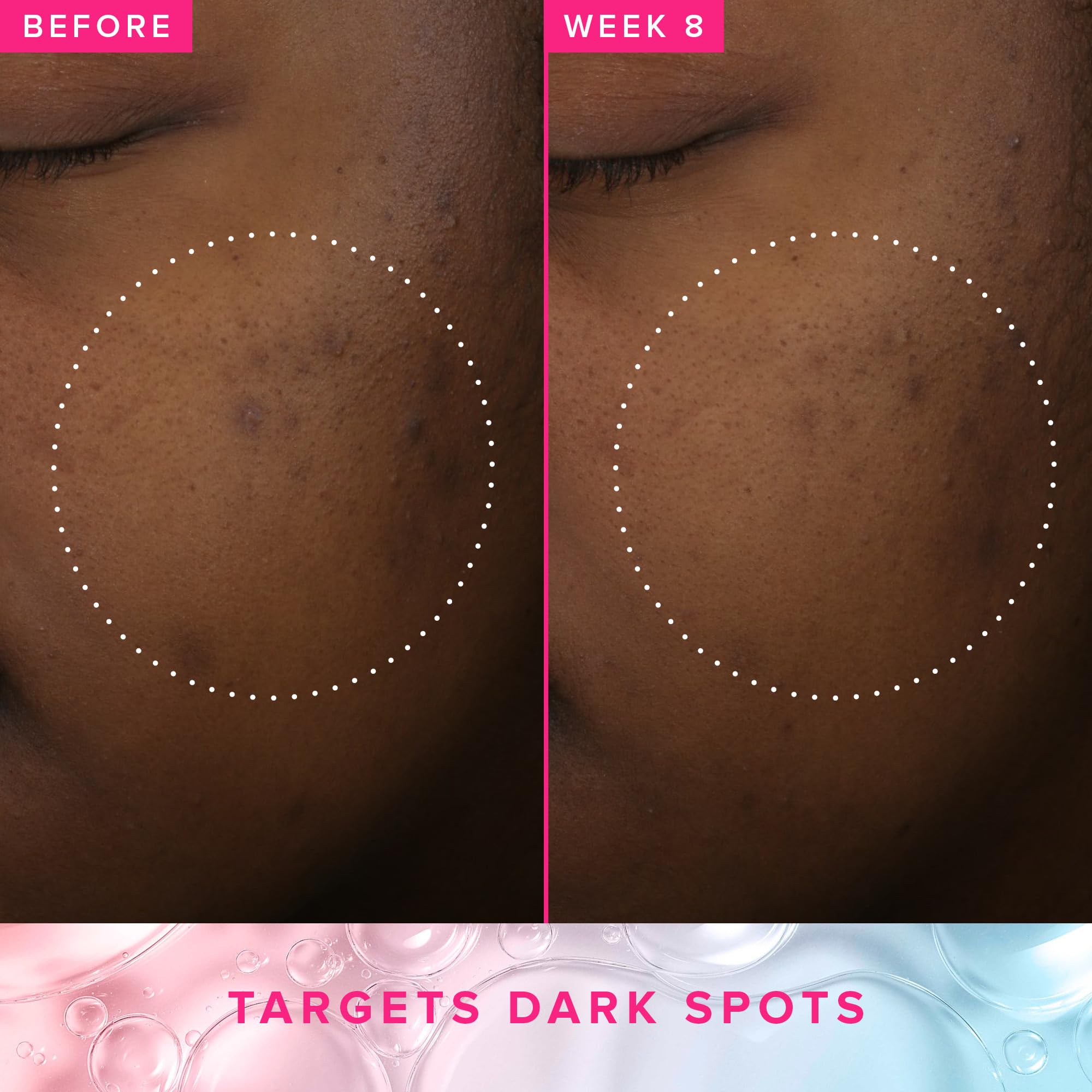 Farmacy tónico PHA 5% exfoliación suave con hidratación.