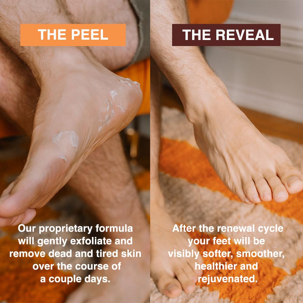 FEETS pies tras desprendimiento con piel suave y renovada.