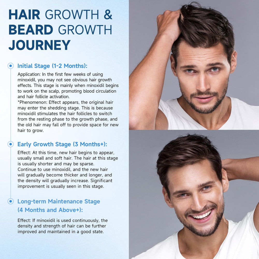 Felicemy Minoxidil salud cuero cabelludo para cuero cabelludo más sano.