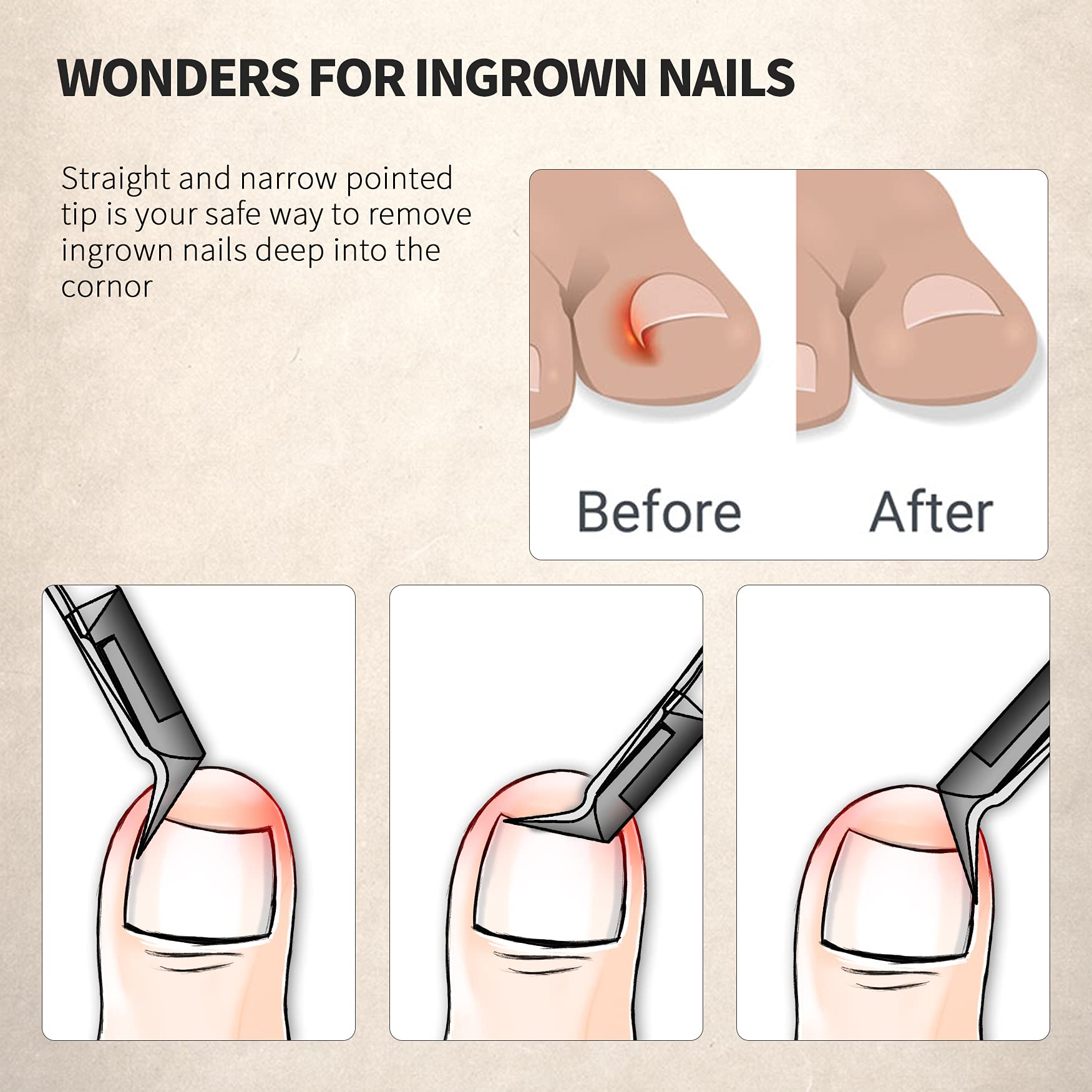 FERYES clipper with wide jaw designed for thick nails