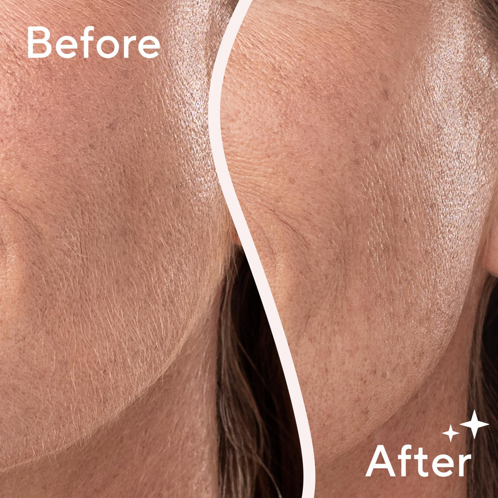Compact handle design of Dermaplane Glo Sonic for comfortable grip.
