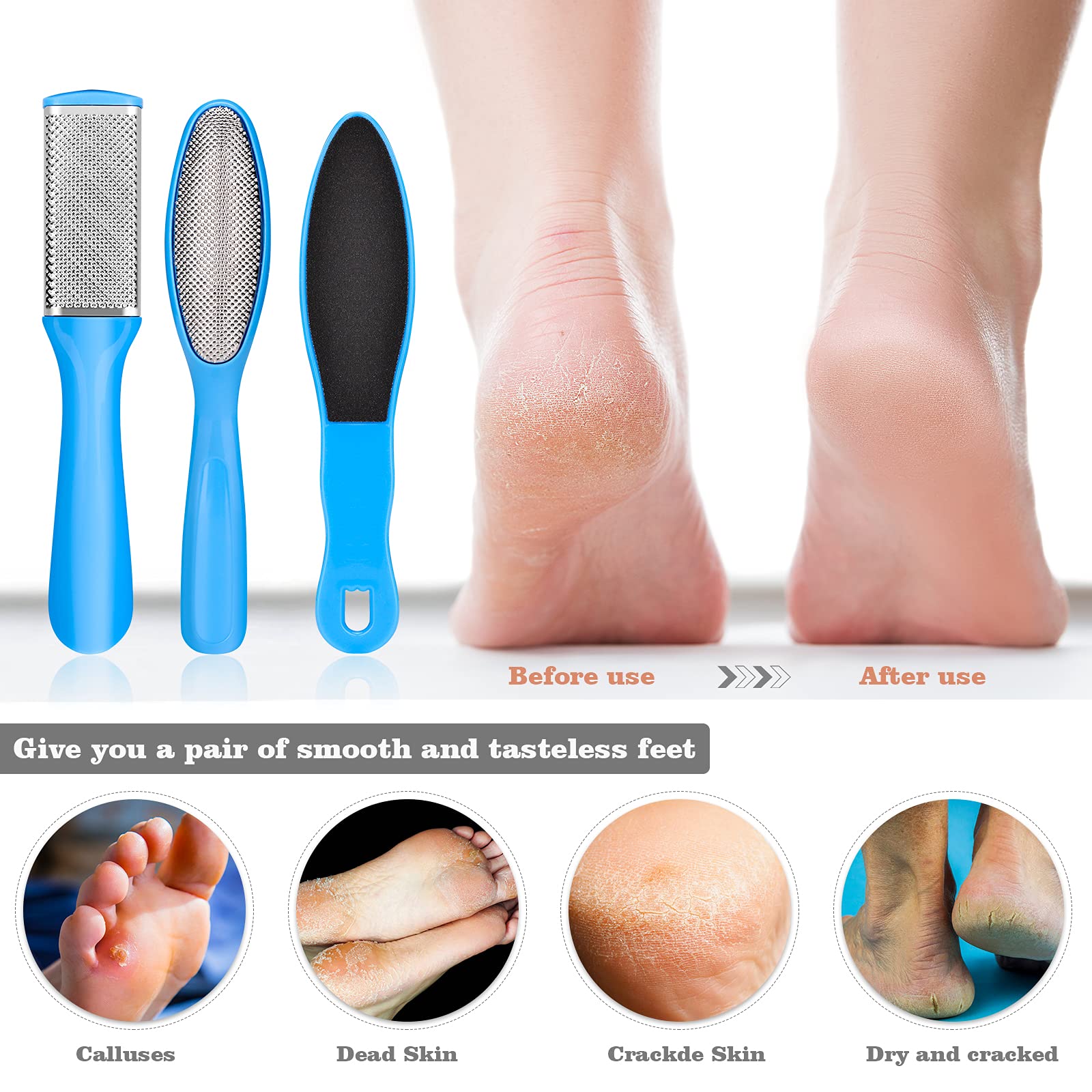 FINTOZER cuticle remover for tidy nails at home