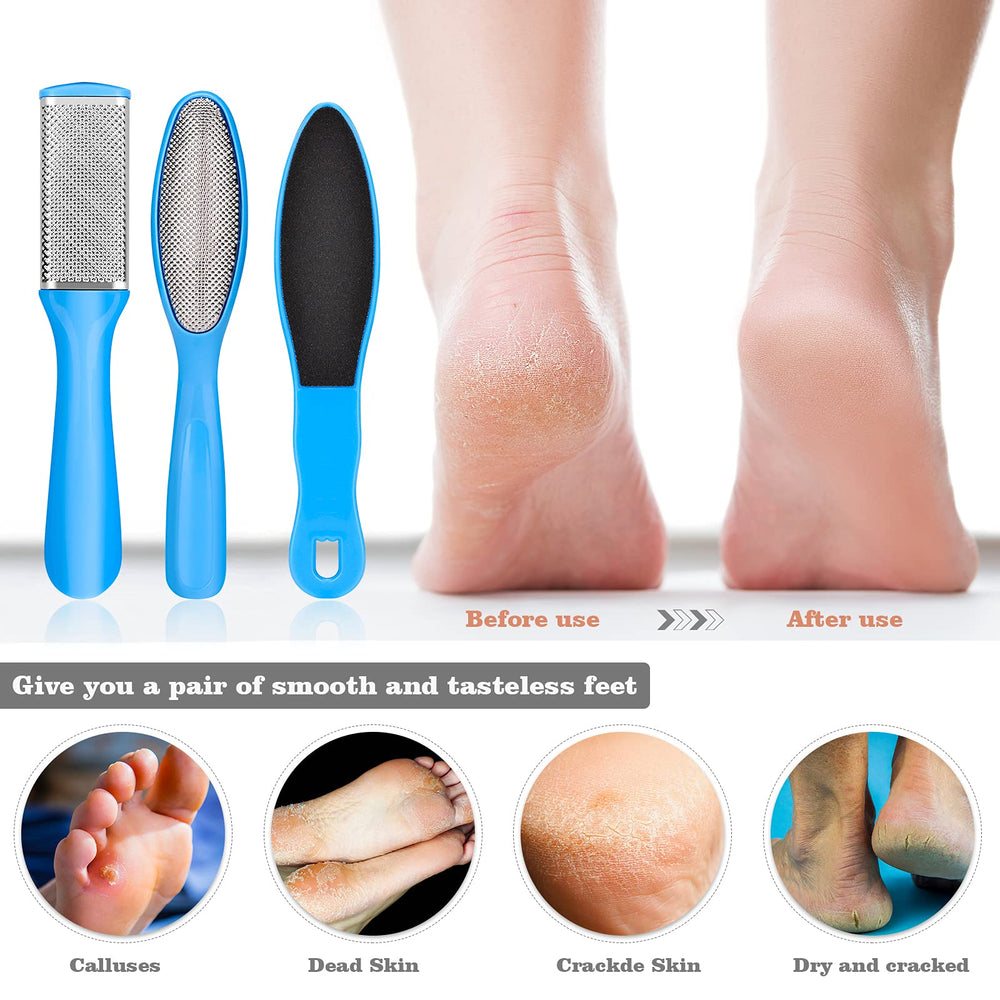 FINTOZER cuticle remover for tidy nails at home