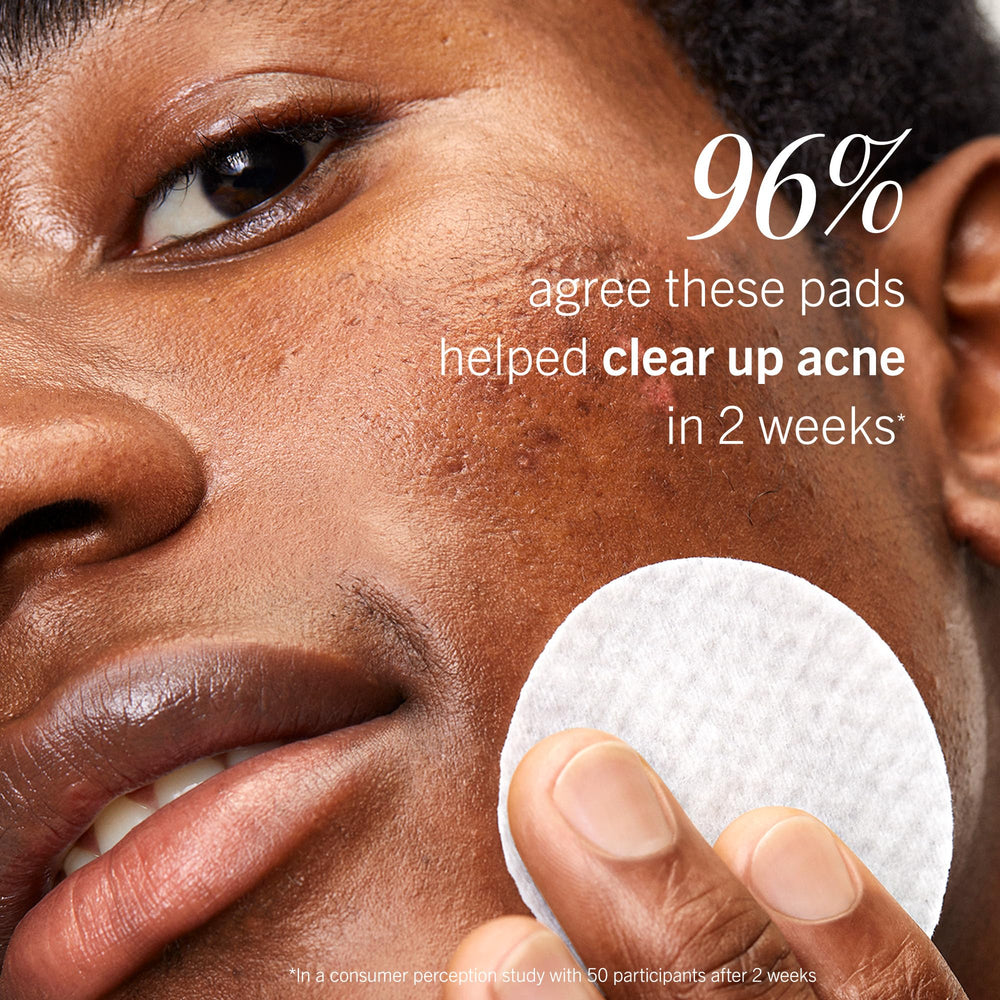 First Aid Beauty acne pads face gentle formula without alcohol.