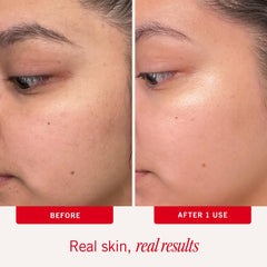 First Aid Beauty facial radiance pads in use showing even tone after cleansing.