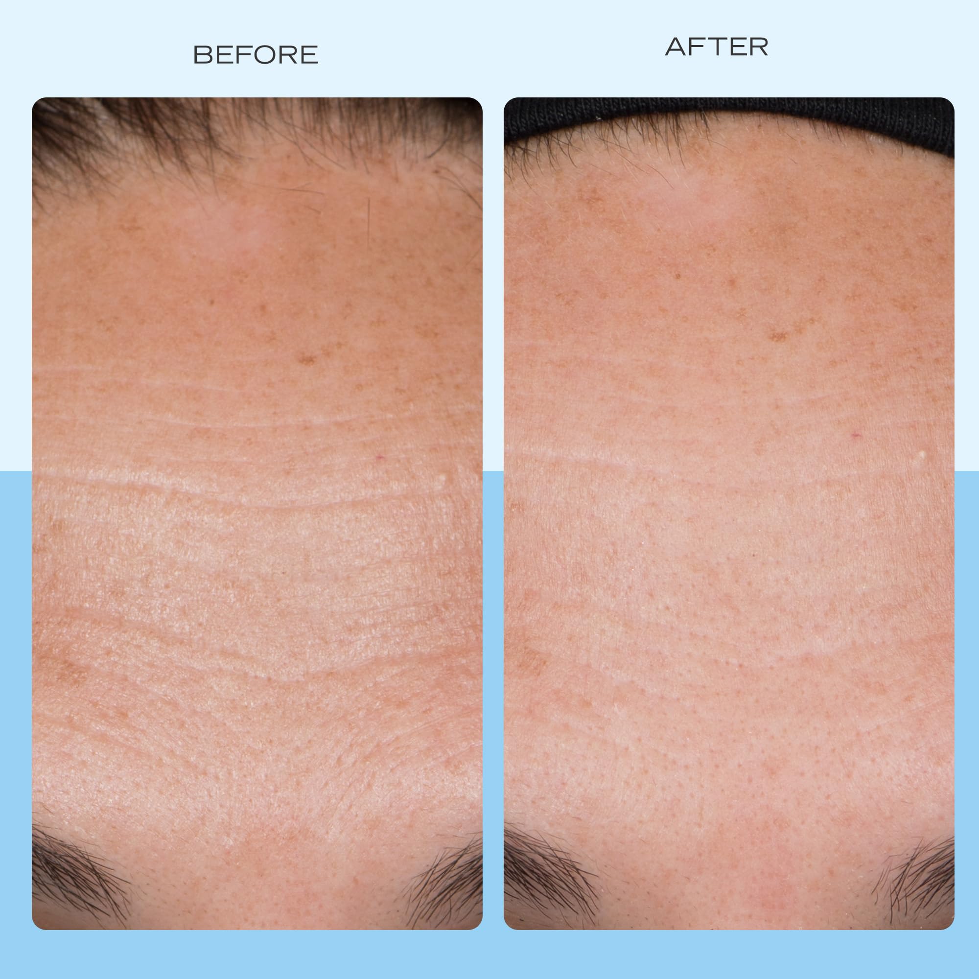 First Aid Beauty Firming Collagen Cream texture swatch on skin showing smoothness.
