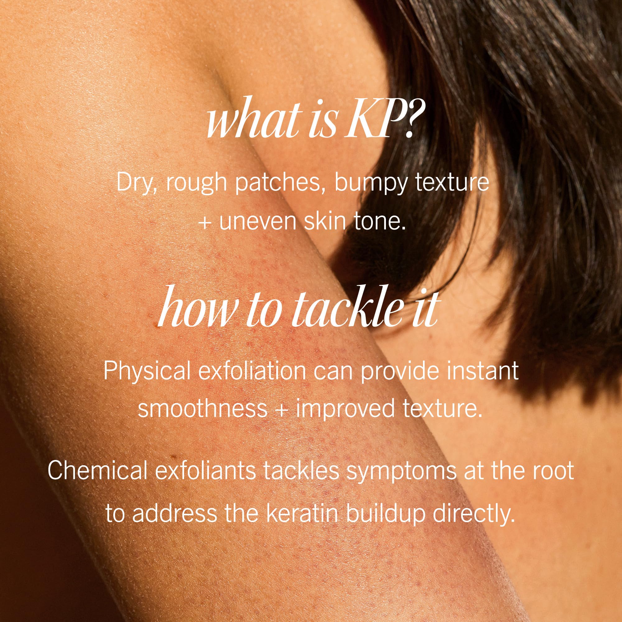 Label of First Aid Beauty KP Bump Eraser shows 10% AHA for renewal.