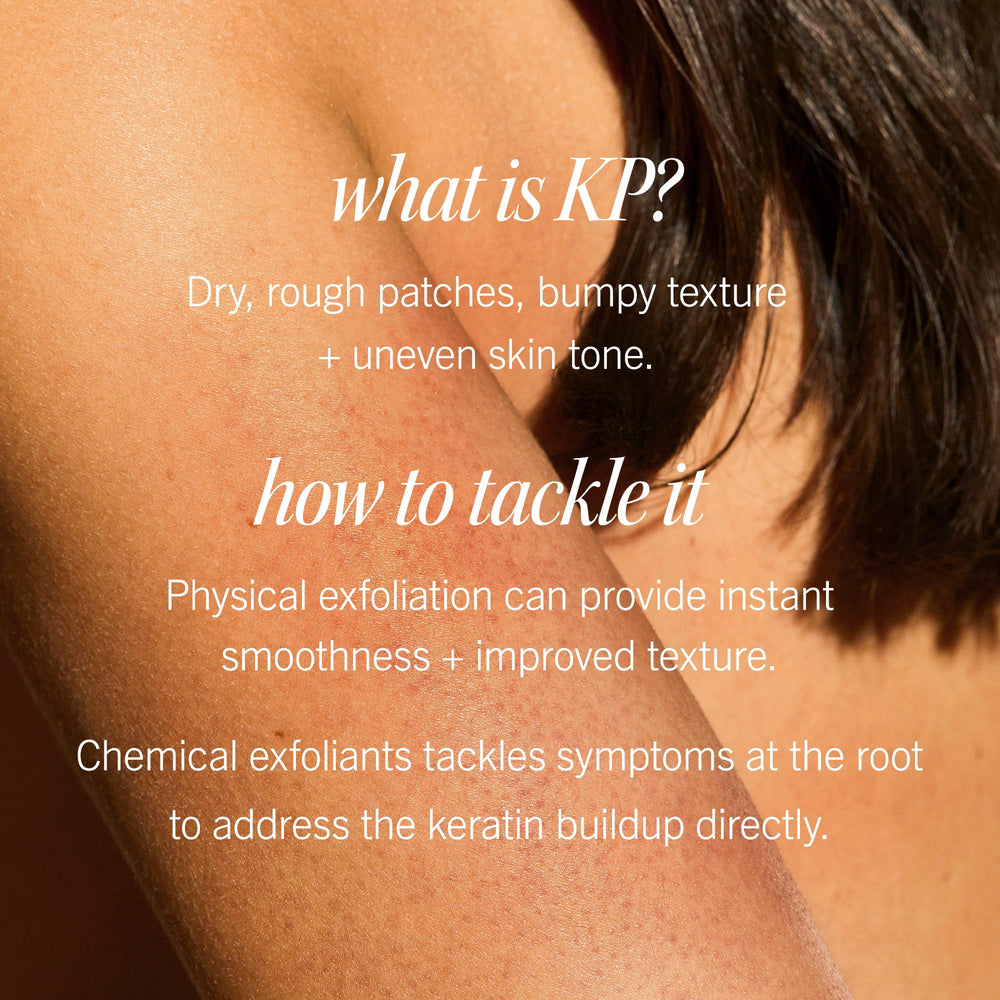 Label of First Aid Beauty KP Bump Eraser shows 10% AHA for renewal.