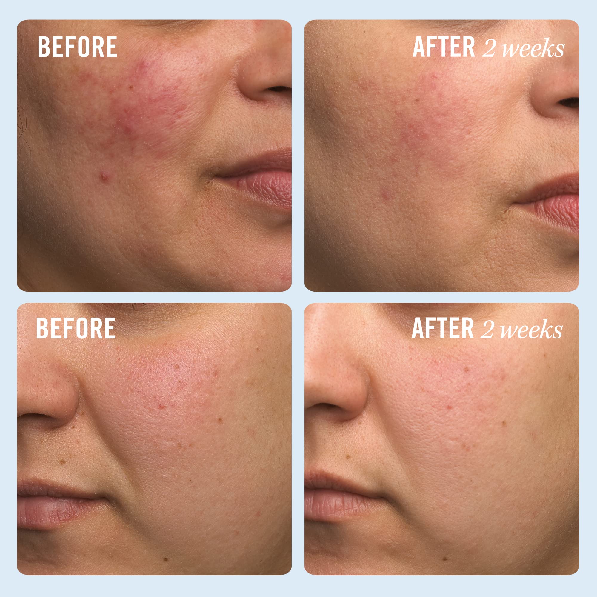 Ultra Repair Cream jar close-up highlighting whipped texture and non-greasy feel.