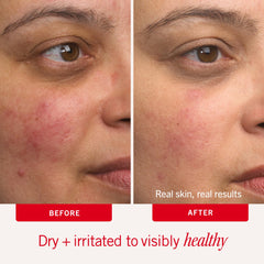First Aid Beauty Ultra Repair Cream label detail emphasizes 0.5% colloidal oatmeal