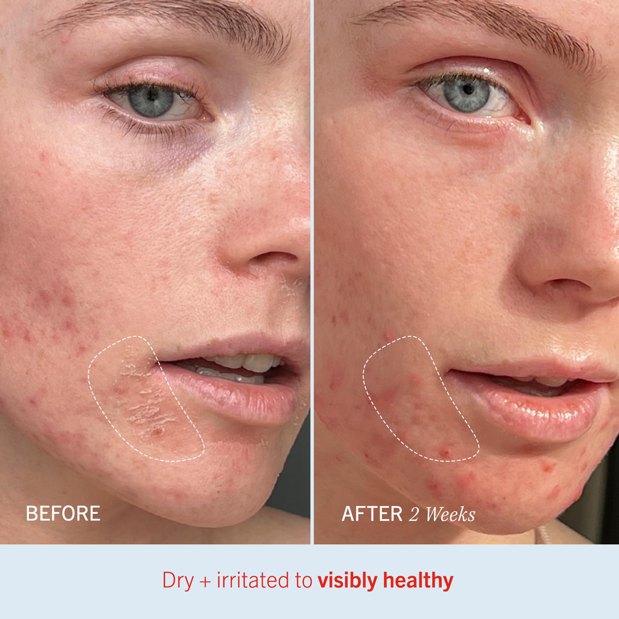 Envase reciclable de Ultra Repair Cream, sin sustancias irritantes