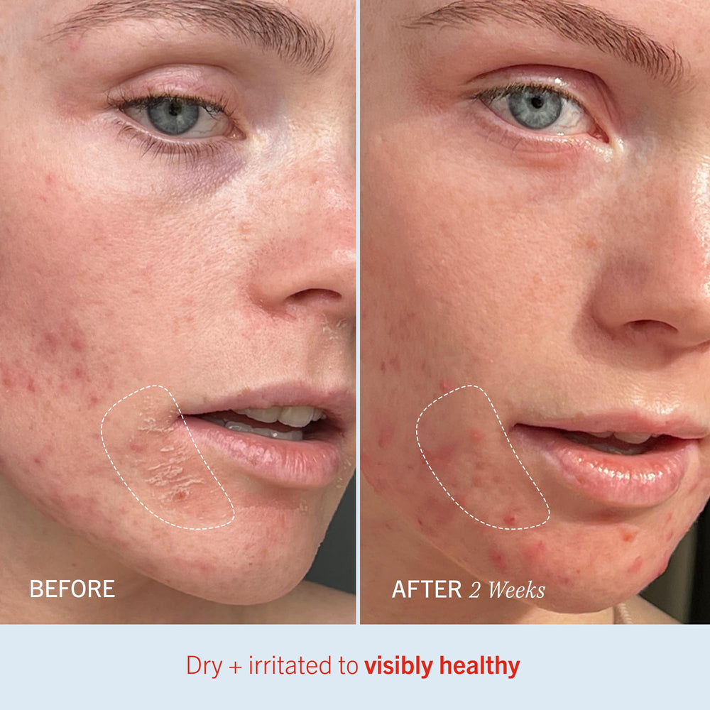 Envase reciclable de Ultra Repair Cream, sin sustancias irritantes