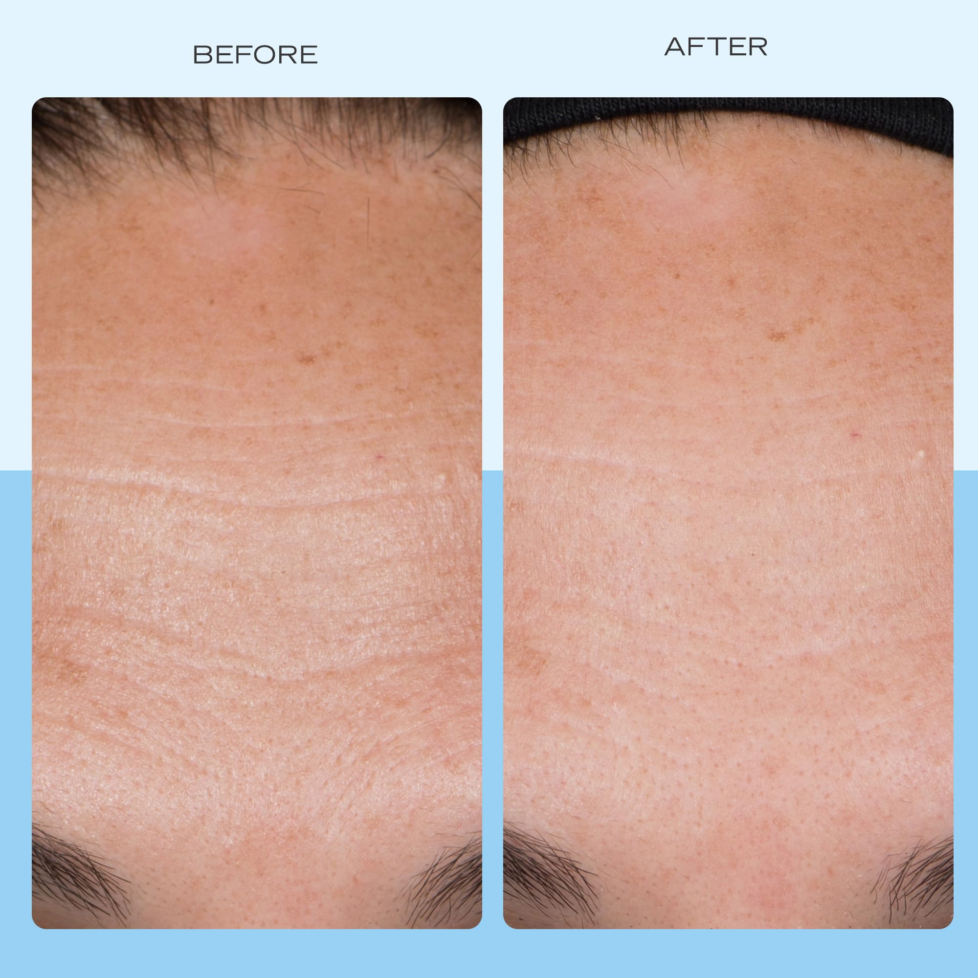 Texture closeup of Ultra Repair Firming Cream on skin for smoothness