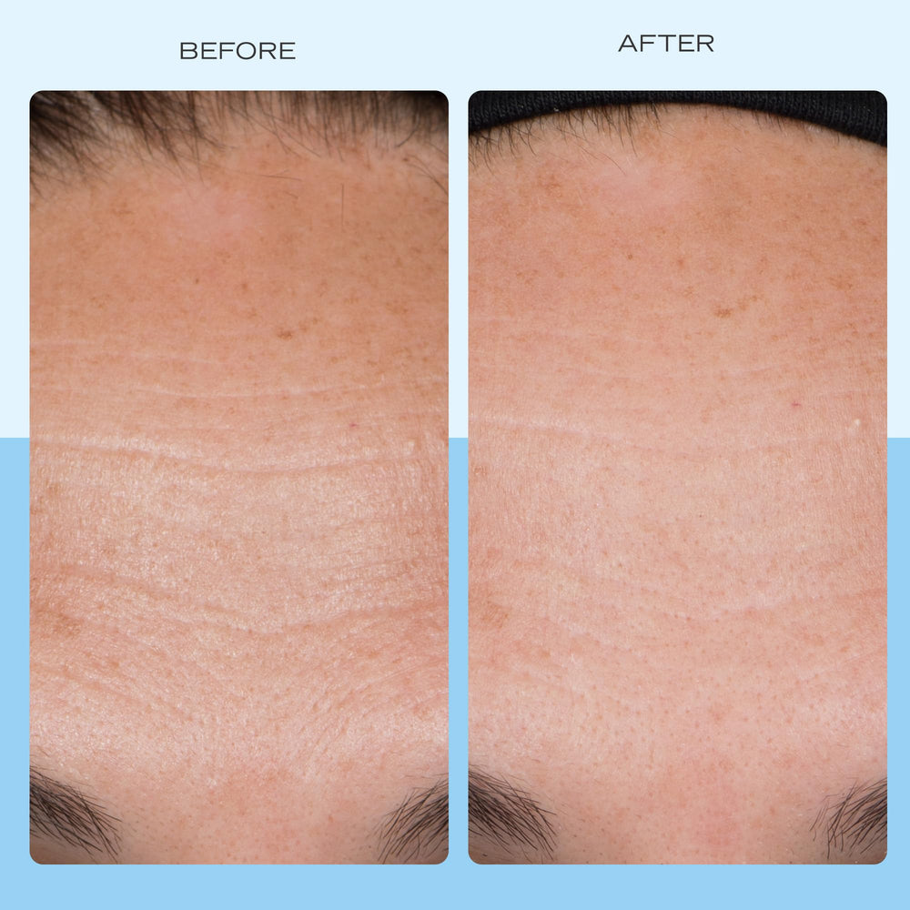 Texture closeup of Ultra Repair Firming Cream on skin for smoothness