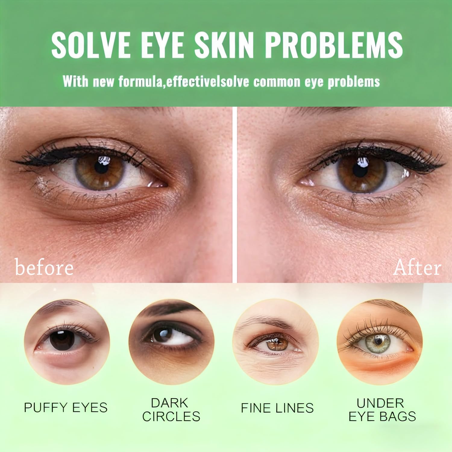 Firstfly avocado eye patches applied under eyes to reduce puffiness.