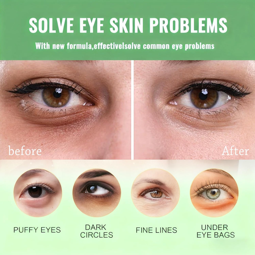 Firstfly avocado eye patches applied under eyes to reduce puffiness.