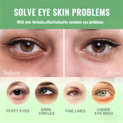 Firstfly avocado eye patches applied under eyes to reduce puffiness.