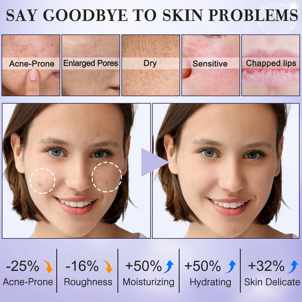 FITOEG tónico facial para adolescentes, prepara la piel para la hidratación diaria.