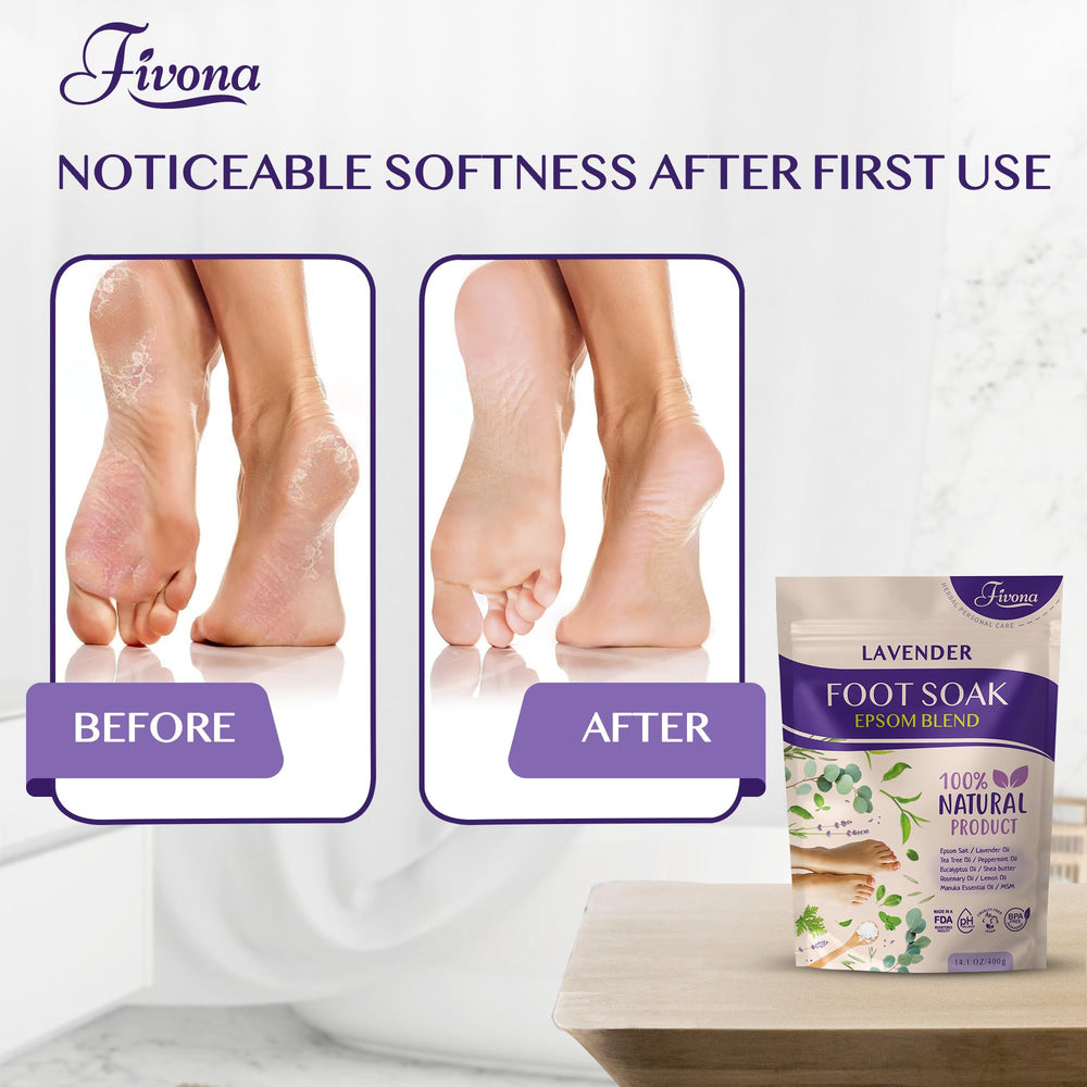 FIVONA aroma lavanda para pies, sensación relajante.