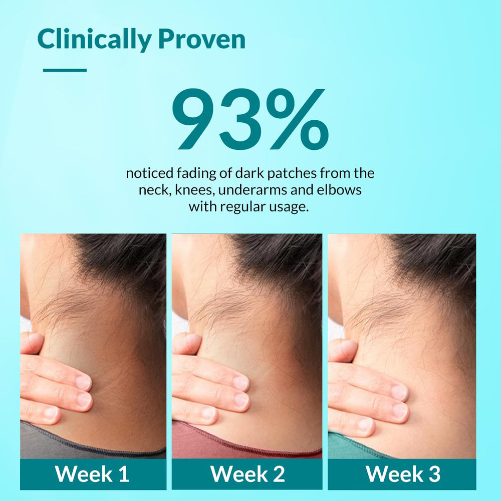 FIXDERMA Nigrifix cream for knuckles softens tough skin.