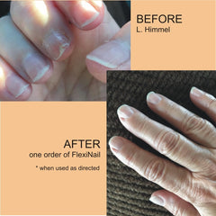 FlexiNail application brush shown for a fast 25-second daily routine.