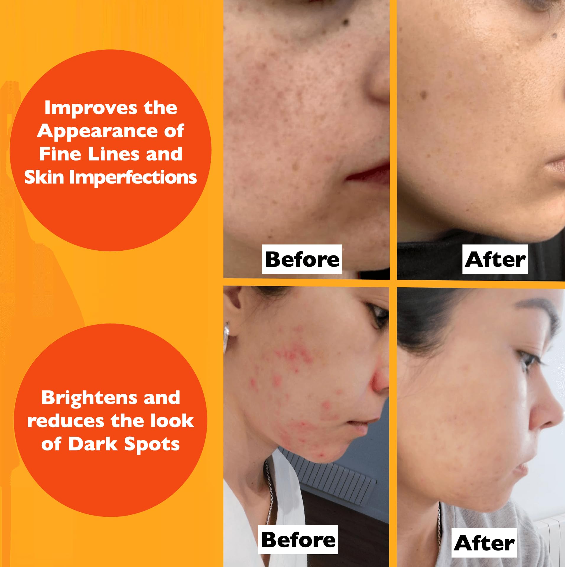 Florence Suero Vitamina C, aplicado en rostro y cuello para un brillo suave.