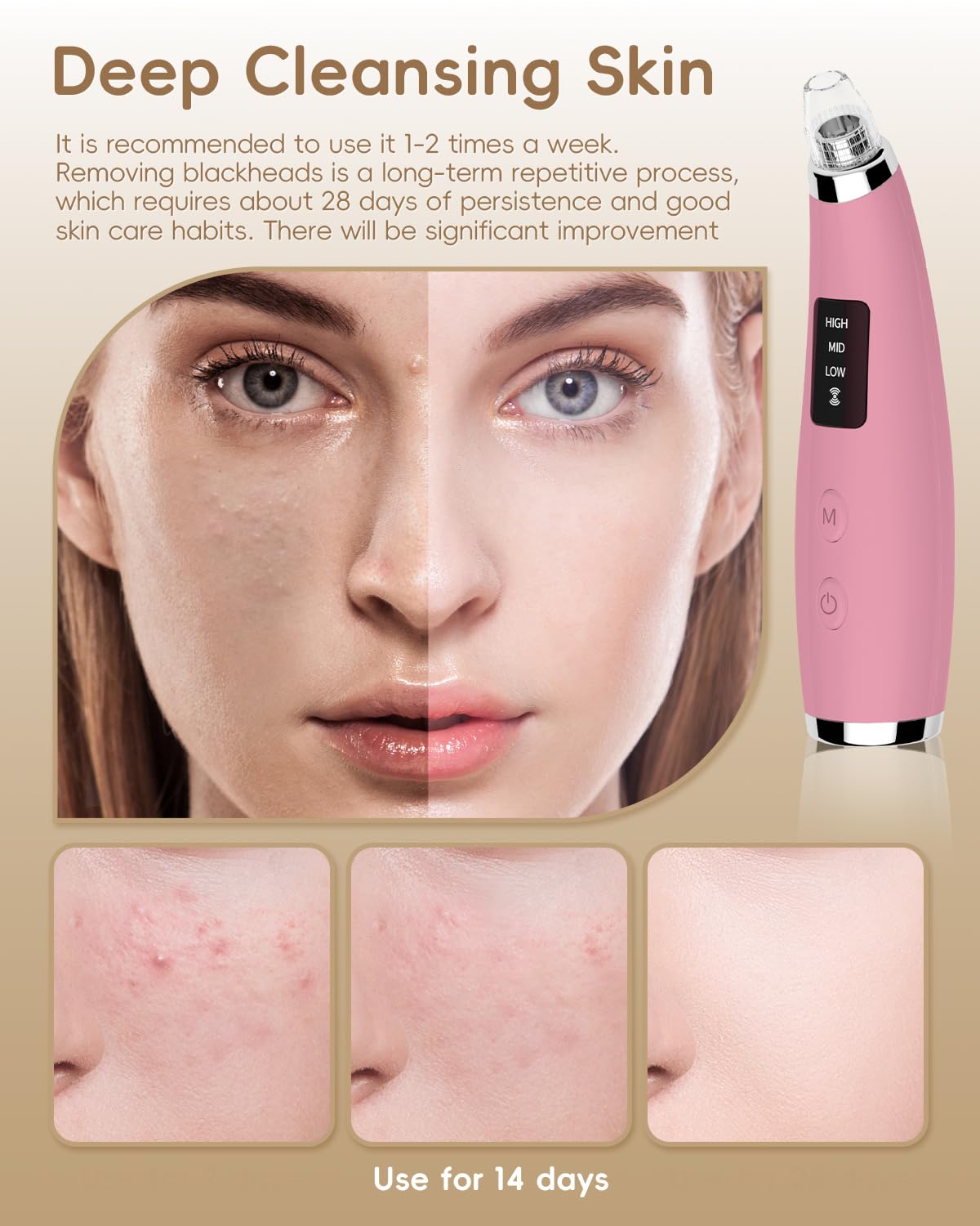 FLYMOOO chin and forehead attachment smooths texture across facial zones.