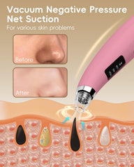 FLYMOOO pore vacuum nose attachment targets nose pores for gentle extraction.