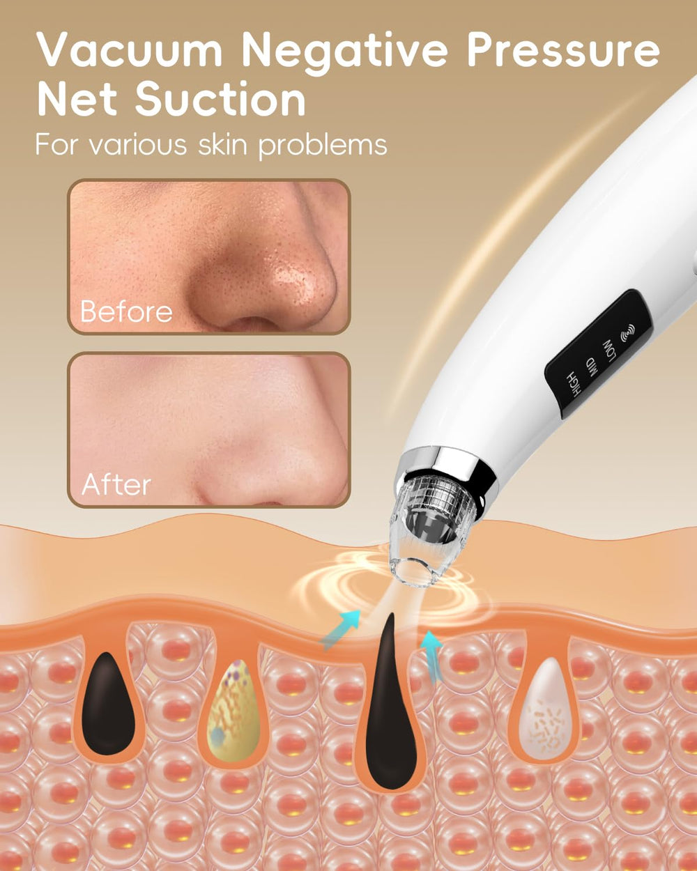 FLYMOOO blackhead vacuum with three suction levels showing adjustable power.
