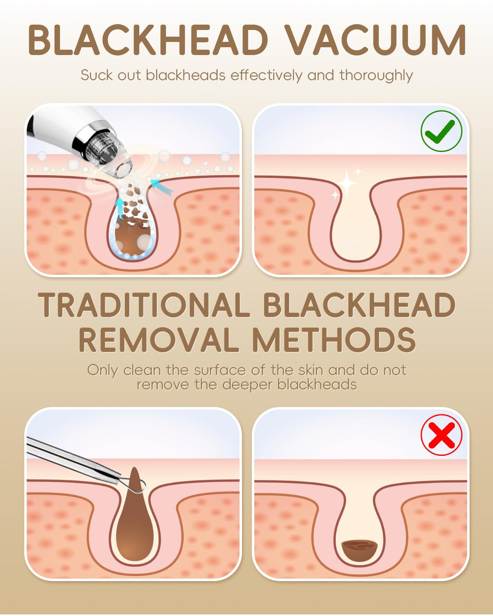 FLYMOOO blackhead vacuum portable design ideal for home and travel.