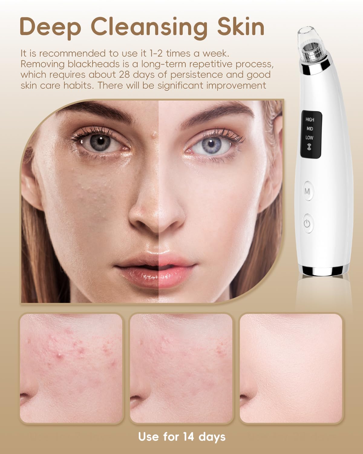 FLYMOOO blackhead vacuum USB rechargeable design for cord-free convenience.