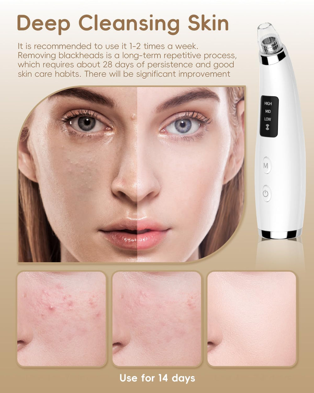 FLYMOOO blackhead vacuum USB rechargeable design for cord-free convenience.
